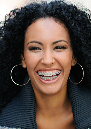 Offrez-vous des broches dentaires de qualité qui vous donnera un sourire radieux - Trois cliniques offrent des broches dentaires soit à Bromont et Cowansville ainsi qu'à Sutton